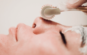 Vampire Facial